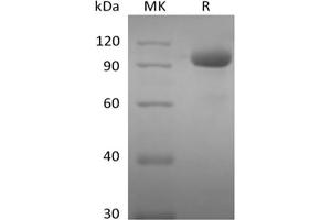 Western Blotting (WB) image for EPH Receptor A8 (EPHA8) protein (Fc Tag) (ABIN7319897)