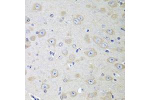 Immunohistochemistry of paraffin-embedded mouse brain using YES1 antibody (ABIN5974700) at dilution of 1/100 (40x lens). (YES1 anticorps)