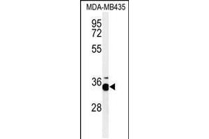 Western blot analysis of PHB2-Y248in MDA-MB435 cell line lysates (35ug/lane)