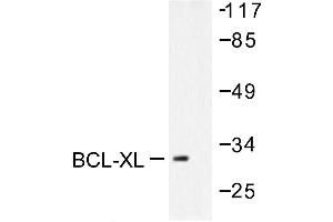 Image no. 1 for anti-BCL2-Like 1 (BCL2L1) antibody (ABIN265327) (BCL2L1 anticorps)
