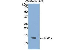 Western Blotting (WB) image for anti-Slit Homolog 2 (Drosophila) (SLIT2) (AA 1408-1519) antibody (ABIN1860578)