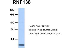Human Jurkat; Host: Rabbit . (RNF138 anticorps  (C-Term))