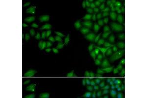 Immunofluorescence analysis of HeLa cells using NEFL Polyclonal Antibody (NEFL anticorps)