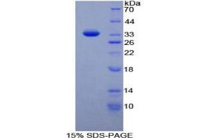 SDS-PAGE analysis of Rat Nucleoporin 88 kDa Protein. (NUP88 Protéine)
