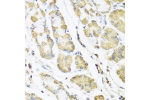 Immunohistochemistry of paraffin-embedded human stomach using MLN antibody (ABIN6128307, ABIN6143890, ABIN6143891 and ABIN6222013) at dilution of 1:100 (40x lens). (Motilin anticorps  (AA 26-115))