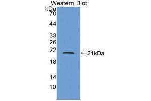 Western blot analysis of the recombinant protein. (CRH anticorps  (AA 40-195))