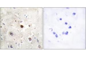 Immunohistochemistry analysis of paraffin-embedded human brain, using p57KIP2 Antibody. (CDKN1C anticorps  (AA 11-60))