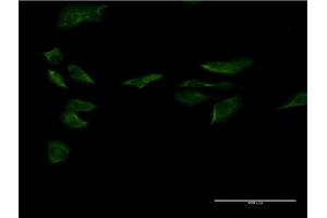 Immunofluorescence of monoclonal antibody to SP1 on HeLa cell. (SP1 anticorps  (AA 522-618))