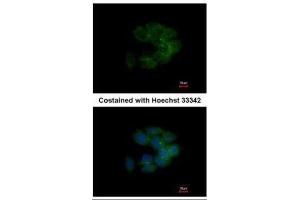 ICC/IF Image Immunofluorescence analysis of methanol-fixed HCT116, using MRCK alpha, antibody at 1:500 dilution.