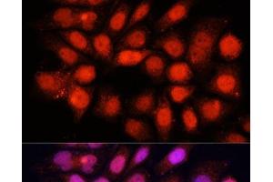 Immunofluorescence analysis of HeLa cells using DDB1 Polyclonal Antibody at dilution of 1:100 (40x lens).