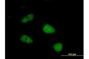 Immunofluorescence of purified MaxPab antibody to SIVA on HeLa cell. (SIVA1 anticorps  (AA 1-110))