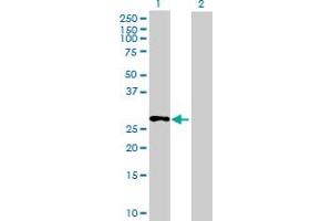 Western Blot analysis of C13orf39 expression in transfected 293T cell line ( H00196541-T01 ) by C13orf39 MaxPab polyclonal antibody. (METTL21C anticorps  (AA 1-264))