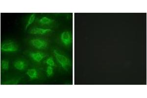 Immunofluorescence analysis of HeLa cells, using DGKI Antibody. (DGKI anticorps  (AA 991-1040))