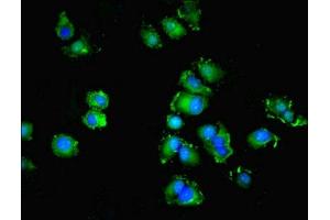 Immunofluorescent analysis of MCF-7 cells using ABIN7166144 at dilution of 1:100 and Alexa Fluor 488-congugated AffiniPure Goat Anti-Rabbit IgG(H+L)