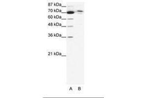Image no. 1 for anti-Chromosome 14 Open Reading Frame 101 (C14orf101) (AA 249-298) antibody (ABIN6736042) (C14orf101 anticorps  (AA 249-298))