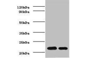 Western BlotPositive WB detected in: mouse heartAll lanes: TIMP1 antibody at 2ug/mlSecondaryGoat polyclonal to rabbit IgG at 1/50000 dilutionPredicted band size: 23 kDaObserved band size: 23 kDa. (TIMP1 anticorps  (AA 24-207))