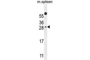 WIBG Antibody (N-term) western blot analysis in mouse spleen tissue lysates (35 µg/lane). (PYM anticorps  (N-Term))