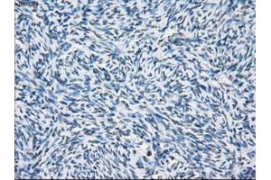 Immunohistochemical staining of paraffin-embedded colon tissue using anti-PSMA7mouse monoclonal antibody.
