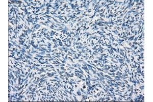 Immunohistochemical staining of paraffin-embedded colon tissue using anti-PSMA7mouse monoclonal antibody. (PSMA7 anticorps)
