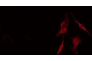 ABIN6276561 staining COLO205 cells by IF/ICC. (BCL2L2 anticorps  (N-Term))