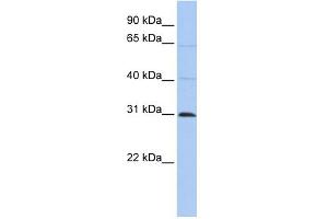 WB Suggested Anti-C1orf184 Antibody Titration:  0. (METTL11B anticorps  (C-Term))