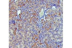 IHC analysis of SLC5A2 using anti-SLC5A2 antibody (ABIN6719506).