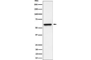 Western blot analysis of RGS6 expression in HeLa cell lysate.