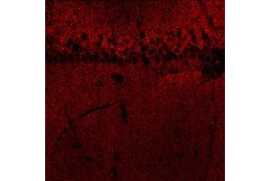 Indirect immunostaining of a rat hippocampus section fixed with 4 % PFA and 15 % picric acid (dilution 1 : 500).