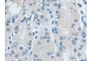 Detection of VCP in Human Stomach Tissue using Polyclonal Antibody to Valosin Containing Protein (VCP)