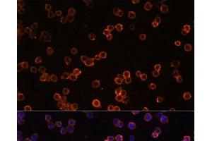 Immunofluorescence analysis of Raw264. (CD39 anticorps)