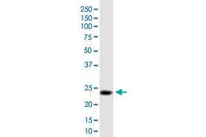 MGC50273 monoclonal antibody (M01), clone 3B10. (MGC50273 (AA 1-209) anticorps)