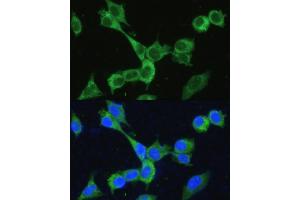 Immunofluorescence analysis of NIH-3T3 cells using MTHFD2 antibody (ABIN6132367, ABIN6144144, ABIN6144145 and ABIN6214625) at dilution of 1:100. (MTHFD2 anticorps  (AA 40-250))