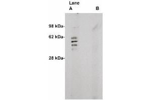 Image no. 1 for anti-Sphingomyelin Synthase 2 (SGMS2) antibody (ABIN265116) (Sphingomyelin Synthase 2 anticorps)