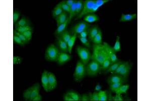 Immunofluorescence staining of HepG2 cells with ABIN7154041 at 1:100, counter-stained with DAPI. (PET112L anticorps  (AA 301-383))