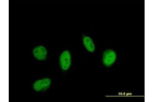 Immunofluorescence of purified MaxPab antibody to LITAF on HeLa cell.