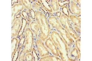 Immunohistochemistry of paraffin-embedded human kidney tissue using ABIN7144749 at dilution of 1:100 (DARS2 anticorps  (AA 489-628))