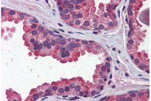 Human Prostate: Formalin-Fixed, Paraffin-Embedded (FFPE)