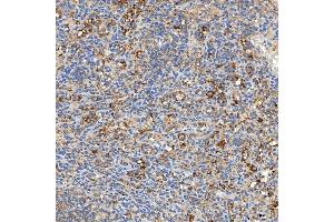 IHC analysis of SNPH using anti-SNPH antibody (ABIN7601724). (Syntaphilin anticorps  (AA 43-482))