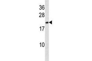 HMGB3 antibody western blot analysis in NCI-H292 lysate. (HMGB3 anticorps  (AA 50-79))