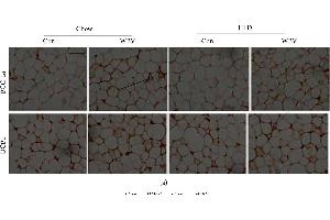 Protein expression of UCP1 and PGC-1α in WAT.
