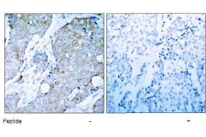 Image no. 1 for anti-VEGF Receptor 2 (VEGFR2) (AA 1212-1216) antibody (ABIN197238)