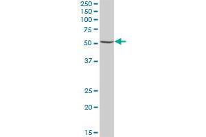 UGDH MaxPab polyclonal antibody.