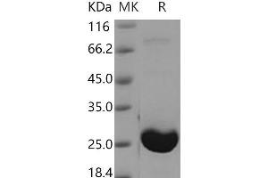Western Blotting (WB) image for Adenylate Kinase 1 (AK1) protein (His tag) (ABIN7194158)