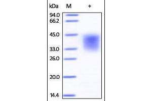 Human LIF on SDS-PAGE under reducing (R) condition. (LIF Protein (AA 23-202))