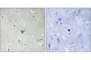Immunohistochemistry analysis of paraffin-embedded human brain tissue, using Bax (Ab-184) Antibody. (BAX anticorps  (AA 143-192))