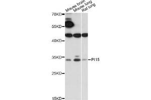 Western blot analysis of extracts of various cell lines, using PI15 antibody (ABIN6289972) at 1:1000 dilution.