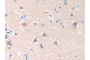 Detection of HLTF in Human Brain Tissue using Polyclonal Antibody to Helicase Like Transcription Factor (HLTF)