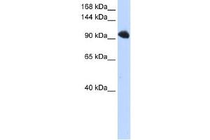 SFRS8 antibody used at 1 ug/ml to detect target protein. (SFRS8 anticorps)