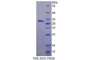SDS-PAGE analysis of Cow CSN1 Protein. (Casein alpha S1 Protein (CSN1S1))