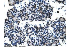 Image no. 1 for anti-Transcription Elongation Factor B (SIII), Polypeptide 3 (110kDa, Elongin A) (TCEB3) (C-Term) antibody (ABIN202907)